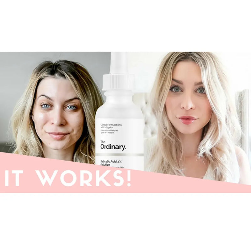 The Ordinary Salicylic Acid 2% Acne Serum