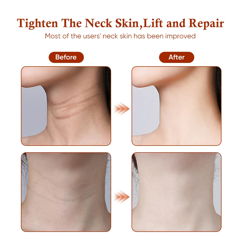 EMS Neck Lifting Massager Microcurrent Electric Neck Massager Wrinkle Remover Device Led Photon Therapy Skin Tightening Face