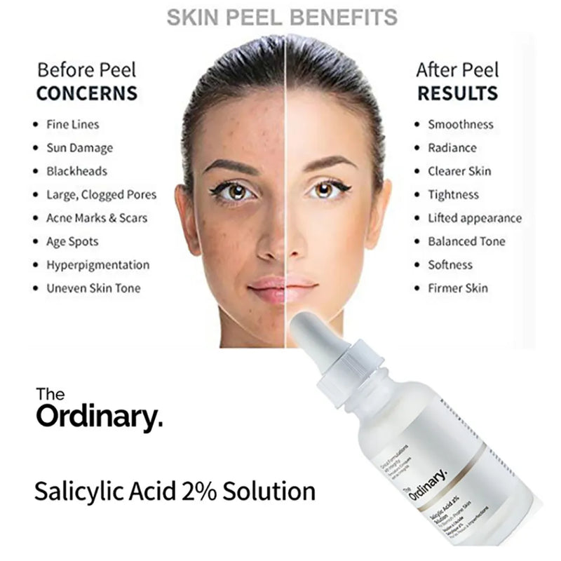 The Ordinary Salicylic Acid 2% Acne Serum