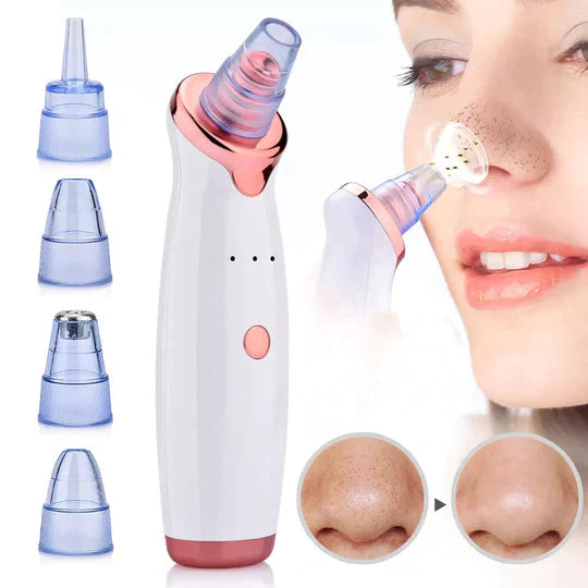 Electric Blackhead Remover 12 Pieces